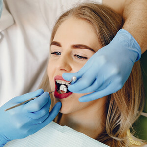 Professional Whitening