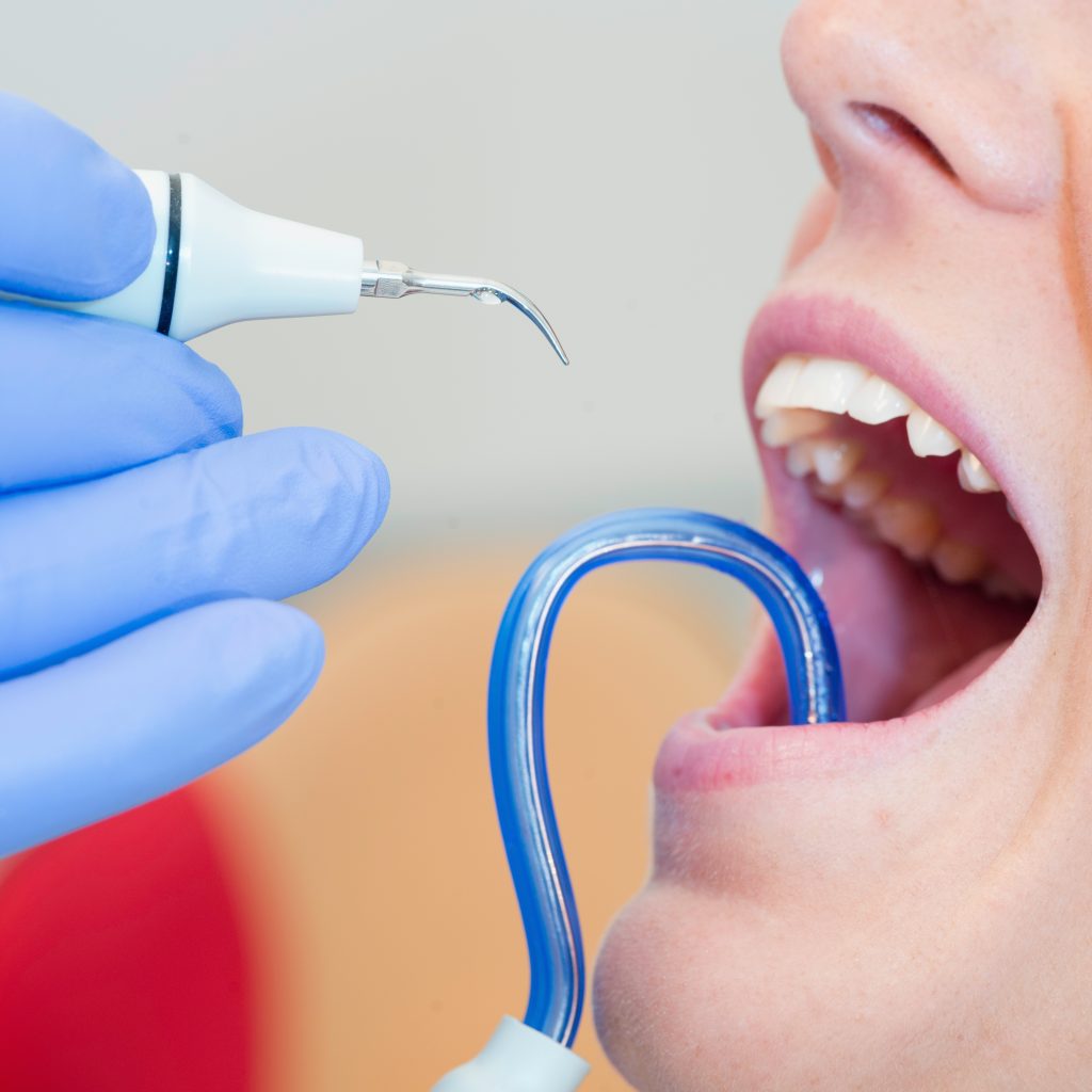 Clean Teeth