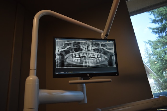Are Dental X-Rays Harmful?