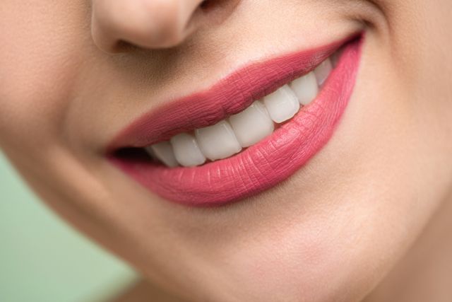 Teeth Whitening Procedure: Brighten Your Smile with Castle Hill Smiles