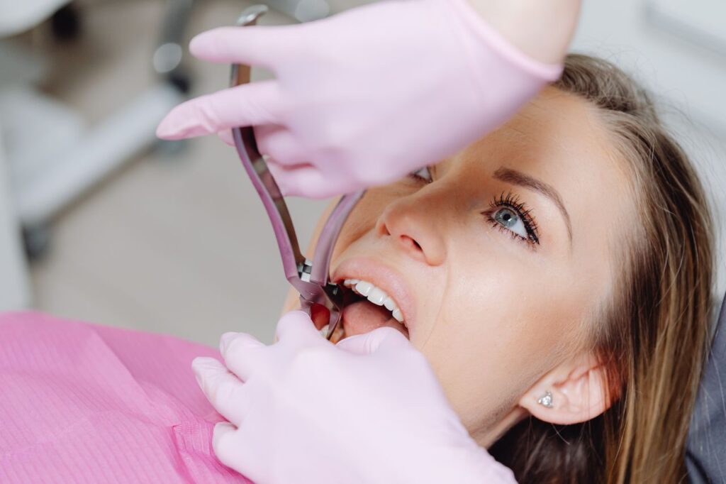 Wisdom teeth extraction